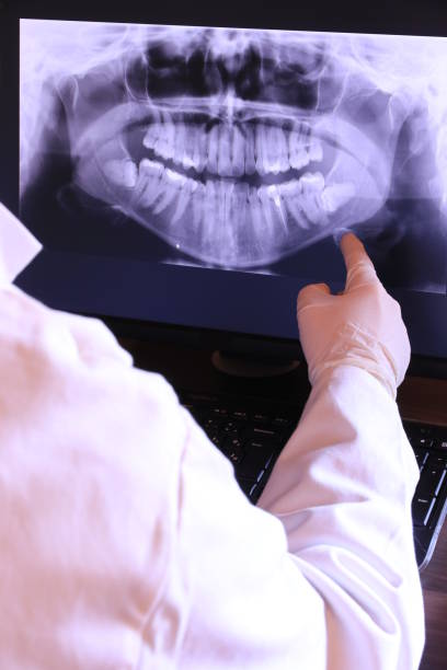Best Emergency Treatment for Dental Infections or Abscesses in Harper, TX