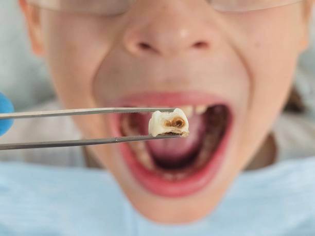Best After-Hours Dental Trauma Care in Harper, TX