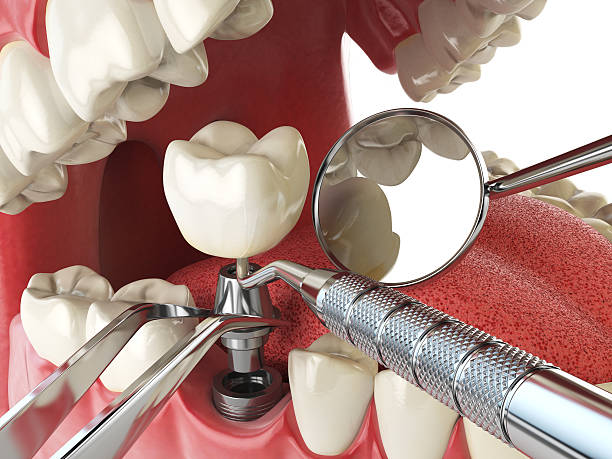 Best Emergency TMJ Treatment in Harper, TX